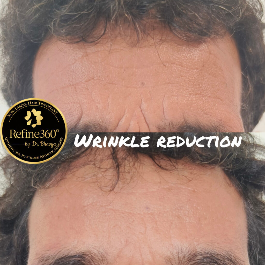 inshot 20260317 123944832