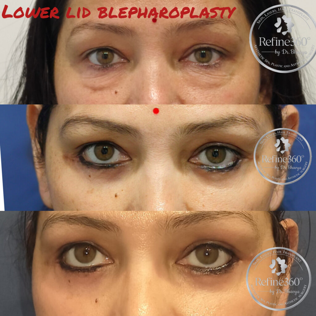 inshot 20260317 124154418