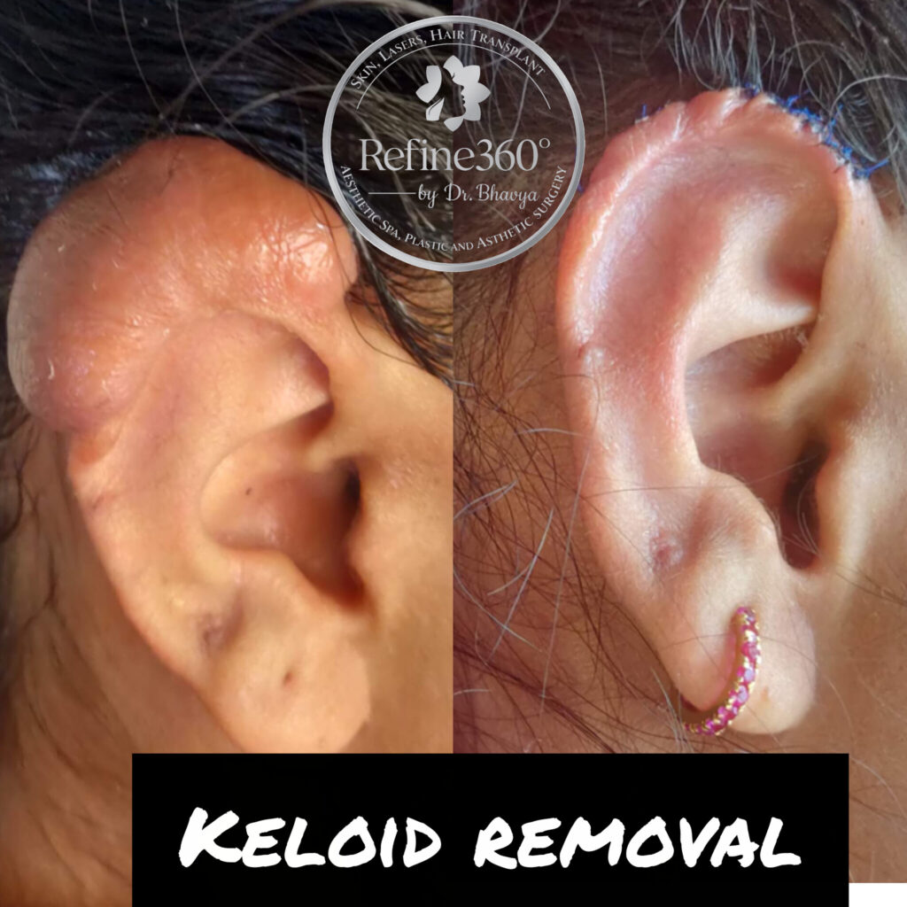 inshot 20260317 124254625