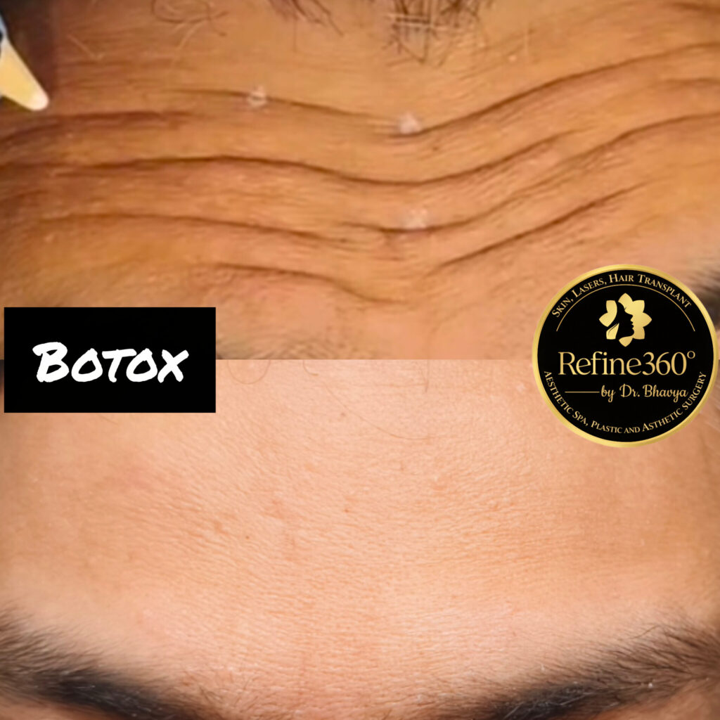 inshot 20260317 124429018