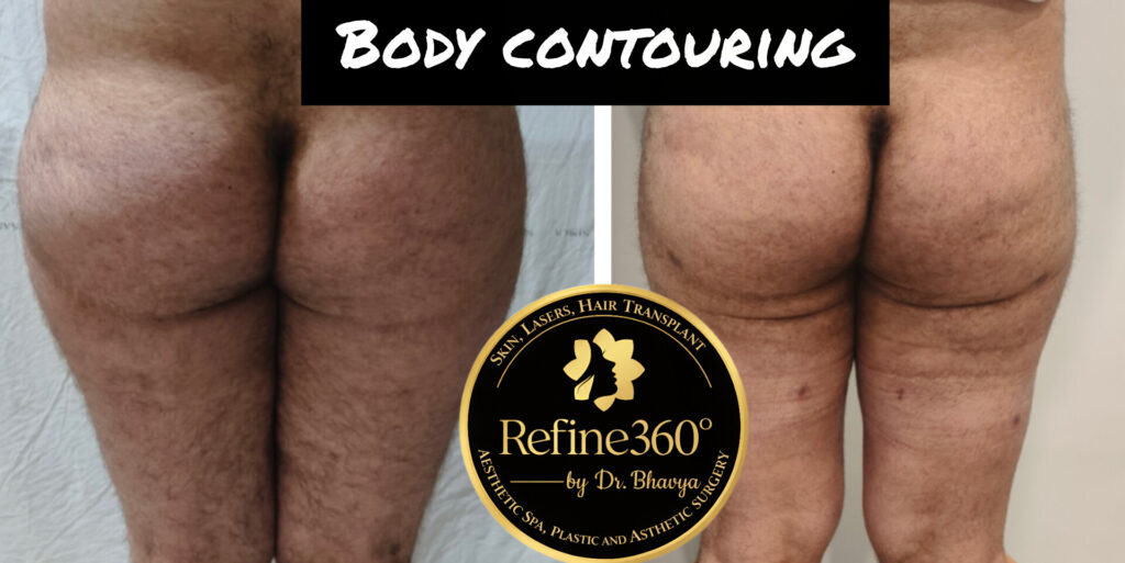 inshot 20260317 124511818