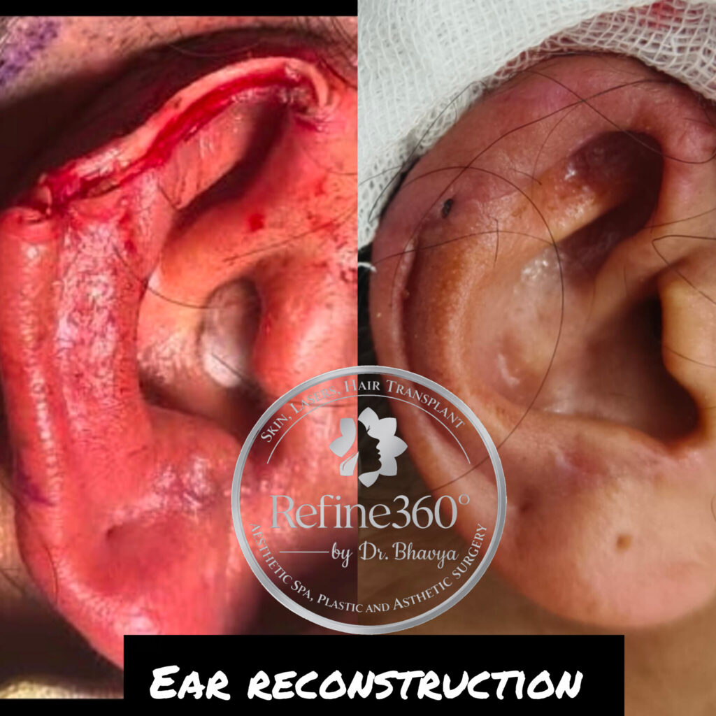 inshot 20260317 124716071