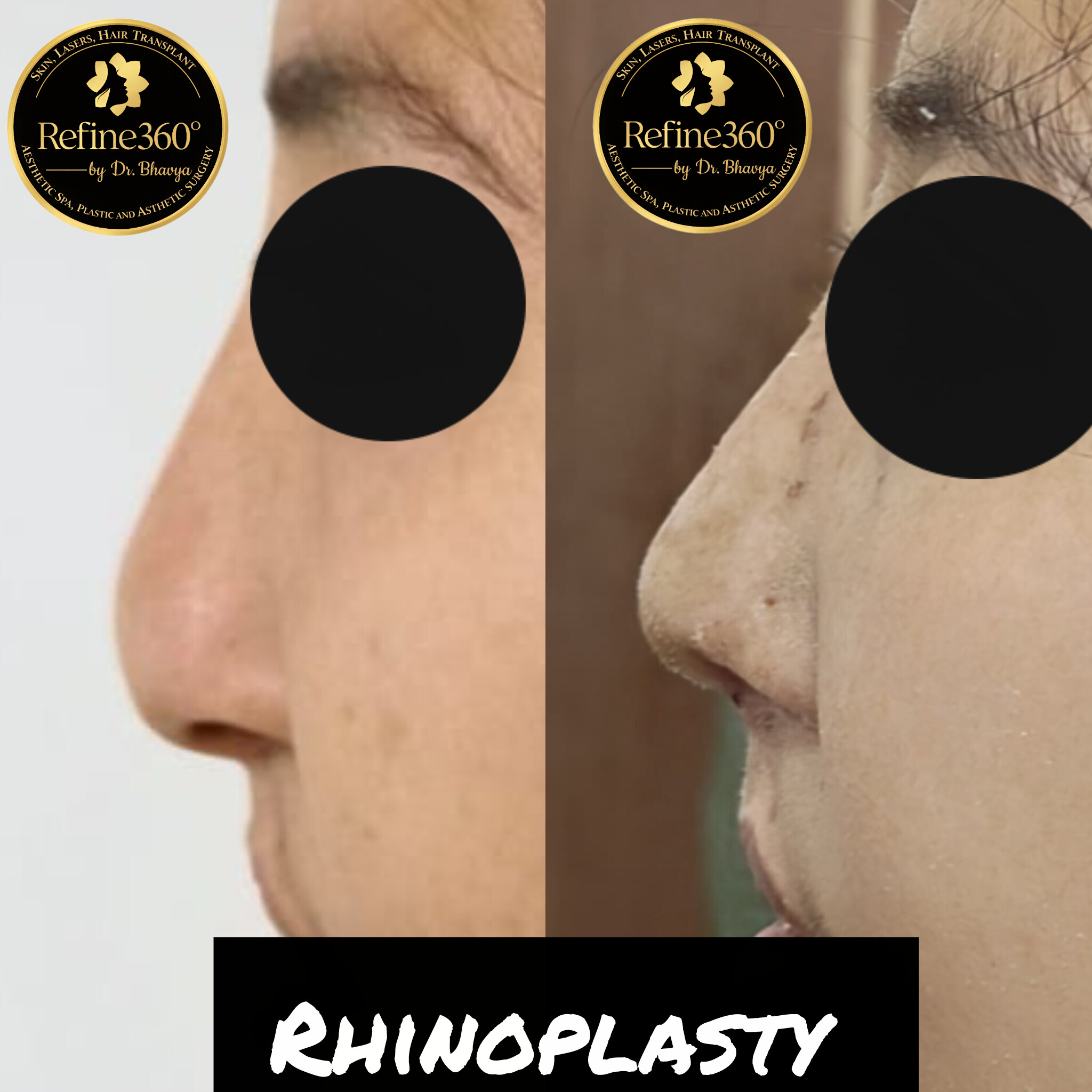 inshot 20260317 124801220