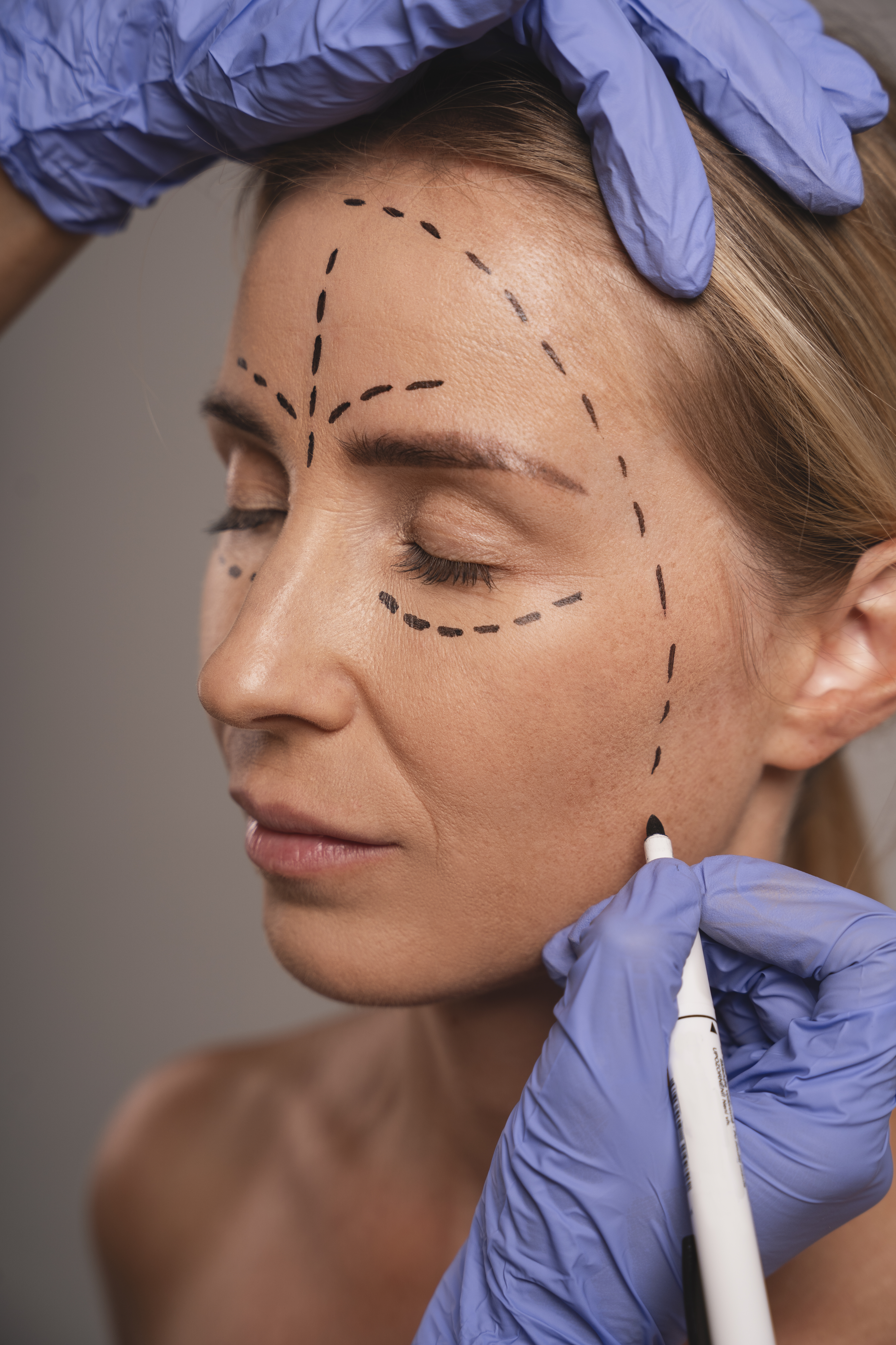 woman preparing cosmetic surgery